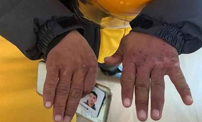 图片[2]-跑美团外卖副业多少钱一单-说说搞钱吧，很多人都失业了，大环境也很不好-优创圈