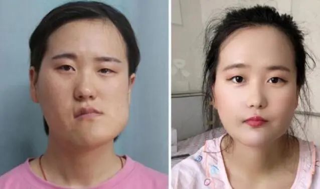 怎么成为网红赚钱-“歪脸女孩”整容后成大美女，本可当网红赚钱，她却选择了这个职业！-优创圈