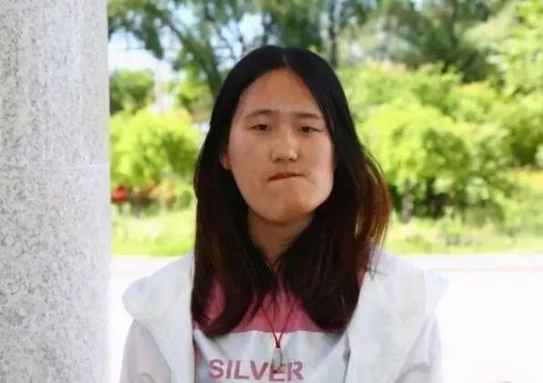 图片[3]-怎么成为网红赚钱-“歪脸女孩”整容后成大美女，本可当网红赚钱，她却选择了这个职业！-优创圈