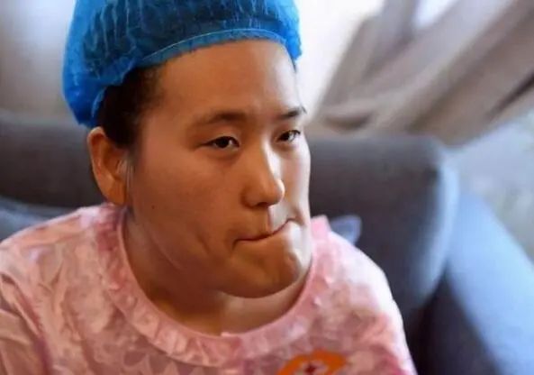 图片[5]-怎么成为网红赚钱-“歪脸女孩”整容后成大美女，本可当网红赚钱，她却选择了这个职业！-优创圈