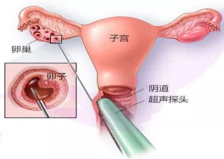 赚钱卖女生东西小说叫什么_赚钱卖女生东西小说_女生卖什么小东西赚钱
