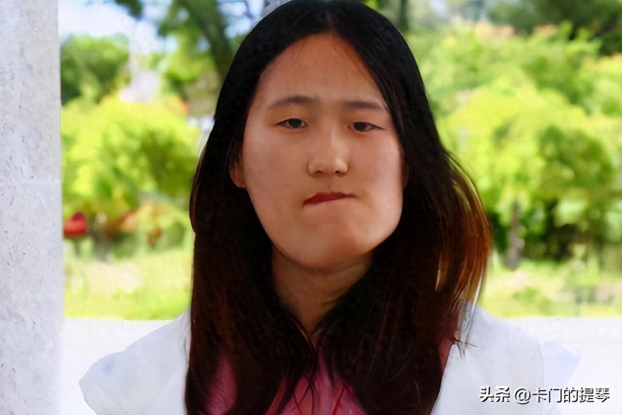 歪脸网靠什么赚钱-辽宁歪脸女孩，父母双亡，她整容变女神，拒网红公司，选择当老师-优创圈
